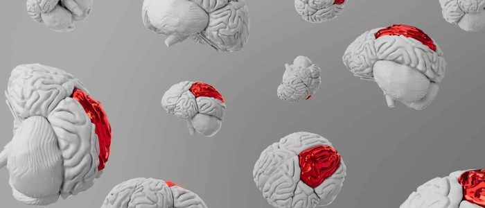 ejemplos de neuromarketing